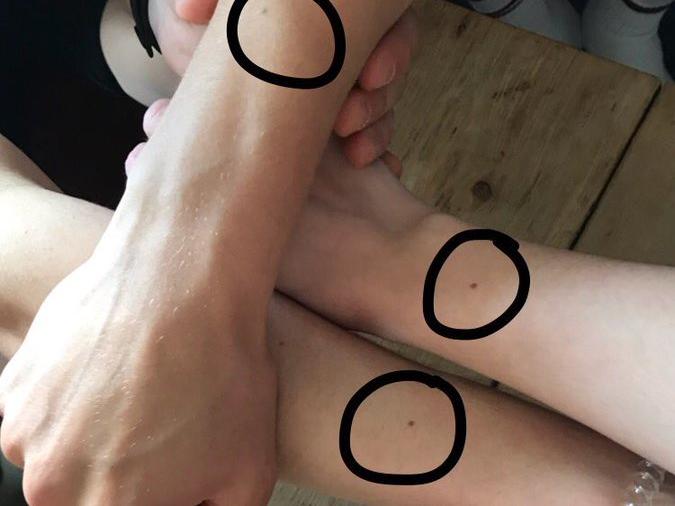 καρπος ελια χερι γυναικες freckle challenge twitter